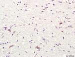 CD80 Antibody in Immunohistochemistry (Paraffin) (IHC (P))