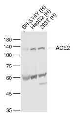 ACE2 Antibody in Western Blot (WB)