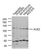 ACE2 Antibody in Western Blot (WB)