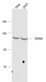 PERK Antibody in Western Blot (WB)