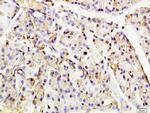 Nucleoporin p62 Antibody in Immunohistochemistry (Paraffin) (IHC (P))