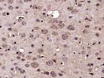 Nucleoporin p62 Antibody in Immunohistochemistry (Paraffin) (IHC (P))