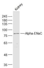 Alpha-ENaC Antibody in Western Blot (WB)