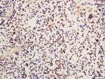 Phospho-Btk (Ser180) Antibody in Immunohistochemistry (Paraffin) (IHC (P))