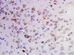 KDM1A Antibody in Immunohistochemistry (Paraffin) (IHC (P))