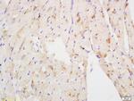 NDUFS3 Antibody in Immunohistochemistry (Paraffin) (IHC (P))