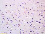 ADCY8 Antibody in Immunohistochemistry (Paraffin) (IHC (P))