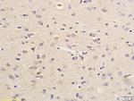 SDHD Antibody in Immunohistochemistry (Paraffin) (IHC (P))