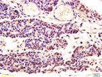 Aspartate Aminotransferase, Cytoplasmic Antibody in Immunohistochemistry (Paraffin) (IHC (P))