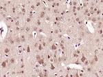 Phospho-AMPK alpha-1/2 (Thr172, Thr183) Antibody in Immunohistochemistry (Paraffin) (IHC (P))