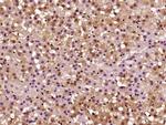 CARM1 Antibody in Immunohistochemistry (Paraffin) (IHC (P))