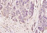 AFP Antibody in Immunohistochemistry (Paraffin) (IHC (P))