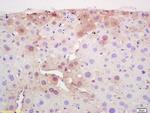 CPT2 Antibody in Immunohistochemistry (Paraffin) (IHC (P))