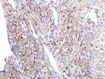 Girdin Antibody in Immunohistochemistry (Paraffin) (IHC (P))