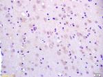 BCAT2 Antibody in Immunohistochemistry (Paraffin) (IHC (P))