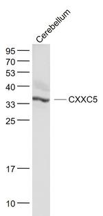 CXXC5 Antibody in Western Blot (WB)