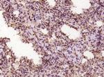 DNA polymerase delta Antibody in Immunohistochemistry (Paraffin) (IHC (P))