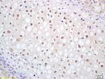 CDC14B Antibody in Immunohistochemistry (Paraffin) (IHC (P))