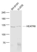 HEATR6 Antibody in Western Blot (WB)