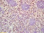 MSX1 Antibody in Immunohistochemistry (Paraffin) (IHC (P))