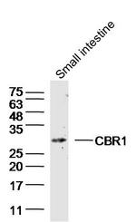 CBR1 Antibody in Western Blot (WB)