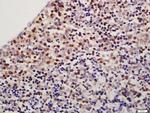 TXNDC9 Antibody in Immunohistochemistry (Paraffin) (IHC (P))