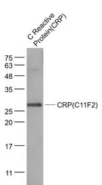 CRP Antibody in Western Blot (WB)