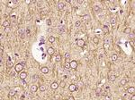 Beta tubulin Antibody in Immunohistochemistry (Paraffin) (IHC (P))