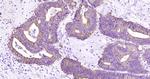 CK18 Antibody in Immunohistochemistry (Paraffin) (IHC (P))