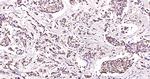 CK18 Antibody in Immunohistochemistry (Paraffin) (IHC (P))