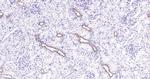 CK18 Antibody in Immunohistochemistry (Paraffin) (IHC (P))