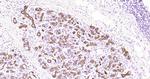 CK18 Antibody in Immunohistochemistry (Paraffin) (IHC (P))