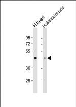 PDK2 Antibody in Western Blot (WB)