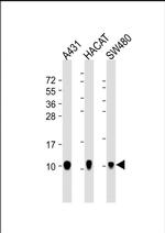 S100A2 Antibody in Western Blot (WB)