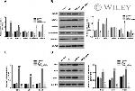 MMP9 Antibody in Western Blot (WB)