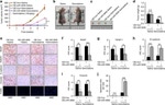 TWIST1 Antibody in Immunohistochemistry (IHC)