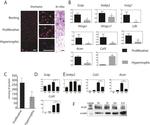 SCAP Antibody in Western Blot, Immunohistochemistry (WB, IHC)