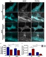 HuC/HuD Antibody in Immunohistochemistry (IHC)