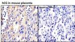 hCG Antibody in Immunohistochemistry (Paraffin) (IHC (P))