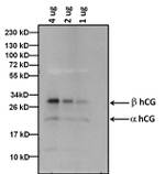 hCG Antibody in Western Blot (WB)