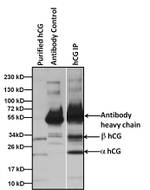 hCG Antibody in Immunoprecipitation (IP)