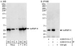 hnRNP-H Antibody in Western Blot (WB)