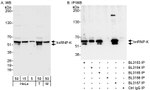 hnRNP-K Antibody in Western Blot (WB)