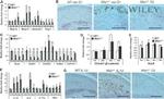 Aggrecan Neo Antibody in Immunohistochemistry (IHC)