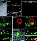 IP3 Receptor 2 Antibody in Immunohistochemistry (IHC)