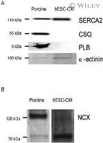 Calsequestrin Antibody in Western Blot (WB)