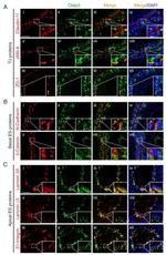 beta Catenin Antibody in Immunohistochemistry (IHC)