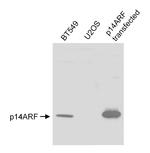 p14ARF Antibody in Western Blot (WB)