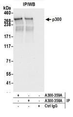 p300 Antibody in Western Blot (WB)