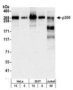 p300 Antibody in Western Blot (WB)